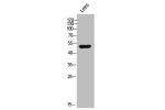 Western Blot analysis of lOVO cells using AR-a1A Polyclonal Antibody
