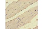 Immunohistochemistry of paraffin-embedded human skeletal muscle tissue using CSB-PA007409LA01HU at dilution of 1:100