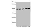 Western blot<br />
All lanes: EEF1A2 antibody at 1.46 ug/ml<br />
Lane 1 : MCF7 whole cell lysate<br />
Lane 2 : Hela whole cell lysate<br />
Lane 3 : Raji whole cell lysate<br />
Lane 4 : HepG-2 whole cell lysate<br />
Lane 5 : A431 whole cell lysate<br 