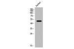 Western Blot analysis of Jurkat cells using AR a2A Polyclonal Antibody