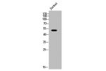 Western Blot analysis of JK cells using AR-a2A Polyclonal Antibody