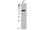 Western Blot analysis of HELA cells using ALS2CR13 Polyclonal Antibody