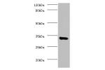 Western blot<br />
All lanes: Elongation factor 1-delta antibody at 2ug/ml+MCF-7 whole cell lysate<br />
Secondary<br />
Goat polyclonal to Rabbit lgG at 1/15000 dilution<br />
Predicted band size: 32,72,29,30 kDa<br />
Observed band size: 31 kDa<br />