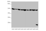Western blot<br />
All lanes:EEF1G antibody at 0.73 ug/ml<br />
Lane 1 : Mouse gonadal tissue<br />
Lane 2 : Mouse brain tissue<br />
Lane 3 : HL60 whole cell lysate<br />
Lane 4 : NIH/3T3 whole cell lysate<br />
Lane 5 : PC-3 whole cell lysate<br />
Lane