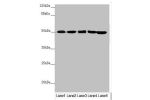 Western blot<br />
All lanes:EEF1G antibody at 0.78 ug/ml<br />
Lane 1 : Mouse gonadal tissue<br />
Lane 2 : PC-3 whole cell lysate<br />
Lane 3 : HepG-2 whole cell lysate<br />
Lane 4 : Hela whole cell lysate<br />
Lane 5 : 293T whole cell lysate<br />
S