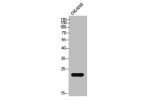 Western Blot analysis of COLO205 cells using Cathepsin G Polyclonal Antibody