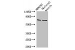 Western Blot<br />
Positive WB detected in:HEK293 whole cell lysate,Mouse skletal muscle tissue<br />
All lanes: EFCAB7 antibody at 2.8ug/ml<br />
Secondary<br />
Goat polyclonal to rabbit IgG at 1/50000 dilution<br />
Predicted band size: 72,70 kDa<br />