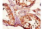Immunohistochemistry of paraffin-embedded human testis tissue using CSB-PA007450LA01HU at dilution of 1:100