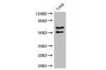 Western Blot<br />
Positive WB detected in:Mouse lung tissue<br />
All lanes: EFEMP2 antibody at 2.7ug/ml<br />
Secondary<br />
Goat polyclonal to rabbit IgG at 1/50000 dilution<br />
Predicted band size: 50 kDa<br />
Observed band size: 50,70 kDa<br />