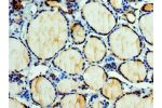 Immunohistochemistry of paraffin-embedded human thyroid using CSB-PA007462ESR2HU at dilution 1:100