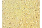 Immunohistochemistry of paraffin-embedded human liver using CSB-PA007465ESR1HU at dilution 1:100