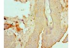 Immunohistochemistry of paraffin-embedded human skin using CSB-PA007466ESR1HU at dilution 1:100