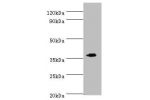 Western blot<br />
All lanes:EFNB2 antibody at 6ug/ml+mouse kidney tissue<br />
Secondary<br />
Goat polyclonal to rabbit at 1/10000 dilution<br />
Predicted band size: 37kDa<br />
Observed band size: 37kDa<br />