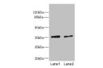 Western blot<br />
All lanes: EFNB3 antibody at 1.44ug/ml<br />
Lane 1 : HepG-2 whole cell lysate<br />
Lane 2 : Hela whole cell lysate<br />
Secondary<br />
Goat polyclonal to rabbit IgG at 1/10000 dilution<br />
Predicted band size: 36 kDa<br />
Observe