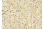 Immunohistochemistry of paraffin-embedded human liver tissue using CSB-PA007467ESR2HU at dilution 1:100