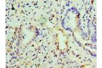 Immunohistochemistry of paraffin-embedded human lung tissue using CSB-PA007482EA01HU at dilution of 1:100
