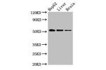 Western Blot<br />
Positive WB detected in:HepG2 whole cell lysate,Rat liver tissue,Rat brain tissue<br />
All lanes:EGR2 antibody at 3.4