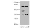 Western blot<br />
All lanes: