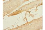 Immunohistochemistry of paraffin-embedded human skeletal muscle tissue using CSB-PA007494ESR2HU at dilution 1:100