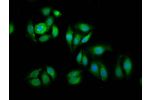 Immunofluorescence staining of A549 cells with CSB-PA007503LA01HU at 1:100,counter-stained with DAPI. The cells were fixed in 4% formaldehyde, permeabilized using 0.2% Triton X-100 and blocked in 10% normal Goat Serum. The cells were then incubated with t