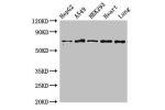 Western Blot<br />
Positive WB detected in:HepG2 whole cell lysate,A549 whole cell lysate,HEK293 whole cell lysate,Rat heart tissue,Rat lung tissue<br />
All lanes:EIF2AK1 antibody at 3