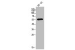 Western Blot analysis of PC-12 cells using CYP2A6 Polyclonal Antibody