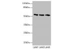 Western blot<br />
All lanes: