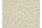 Immunohistochemistry of paraffin-embedded human brain tissue using CSB-PA007535ESR2HU at dilution 1:100