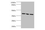 Western blot<br />
All lanes:EIF3H antibody at 7ug/ml<br />
Lane 1:NIH3T3 whole cell lysate<br />
Lane 2:Rat brain tissue<br />
Lane 3:U251whole cell lysate<br />
Secondary<br />
Goat polyclonal to rabbit at 1/10000 dilution<br />
Predicted band size: 40k