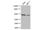 Western Blot<br />
Positive WB detected in:A549 whole cell lysate,MCF-7 whole cell lysate<br />
All lanes: EIF4A3 antibody at 3ug/ml<br />
Secondary<br />
Goat polyclonal to rabbit IgG at 1/50000 dilution<br />
Predicted band size: 47 kDa<br />
Observed b
