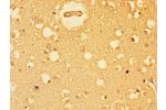 Immunohistochemistry of paraffin-embedded human brain tissue using CSB-PA007556LA01HU at dilution of 1:100