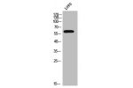 Western Blot analysis of LOVO cells using CYP2C8/9/18/19 Polyclonal Antibody