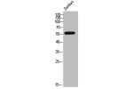 Western Blot analysis of Jurkat cells using CYP3A4/5 Polyclonal Antibody
