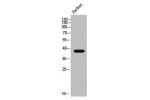 Western Blot analysis of Jurkat cells using NSE2 Polyclonal Antibody