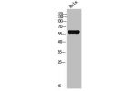Western Blot analysis of HeLa cells using CYP11A1 Polyclonal Antibody