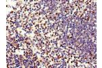 Immunohistochemistry of paraffin-embedded human spleen tissue using CSB-PA007587LA01HU at dilution of 1:100