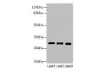 Western blot<br />
All lanes: Chymotrypsin-like elastase family member 3A antibody at 14ug/ml<br />
Lane 1 : Mouse heart tissue<br />
Lane 2 : Mouse skeletal muscle tissue<br />
Lane 3 : Jurkat whole cell lysate<br />
Secondary<br />
Goat polyclonal to Ra