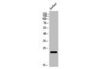 Western Blot analysis of Jurkat cells using AKAP 14 Polyclonal Antibody
