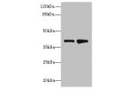 Western blot<br />
All lanes: ELAVL4 antibody at 2ug/ml<br />
Lane 1 : MCF7 whole cell lysate<br />
Lane 2 : 293T whole cell lysate<br />
Secondary<br />
Goat polyclonal to Rabbit IgG at 1/10000 dilution<br />
Predicted band size: 42,41,43 kDa<br />
Obser