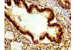 Immunohistochemistry of paraffin-embedded human lung tissue using CSB-PA00759A0Rb at dilution of 1:100