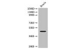 Western Blot<br />
Positive WB detected in:mouse brain tissue<br />
All lanes: ELK1 antibody at 3ug/ml<br />
Secondary<br />
Goat polyclonal to rabbit IgG at 1/50000 dilution<br />
Predicted band size: 45,12 kDa<br />
Observed band size: 45 kDa<br />