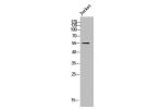 Western Blot analysis of JK cells using CYP21A2 Polyclonal Antibody