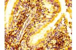 IHC image of CSB-PA007606LA01HU diluted at 1:500 and staining in paraffin-embedded human lung tissue performed on a Leica BondTM system. After dewaxing and hydration, antigen retrieval was mediated by high pressure in a citrate buffer (pH 6.0). Section wa
