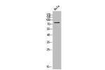 Western Blot analysis of HELA cells using CYP21A2 Polyclonal Antibody