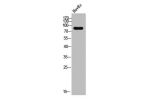 Western Blot analysis of HuvEC cells using DGK-