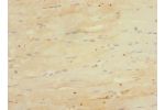 Immunohistochemistry of paraffin-embedded human skeletal muscle tissue using CSB-PA007632ESR1HU at dilution 1:100