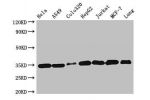 Western Blot<br />
Positive WB detected in:Hela whole cell lysate,A549 whole cell lysate,Colo320 whole cell lysate,HepG2 whole cell lysate,Jurkat whole cell lysate,MCF-7 whole cell lysate,Mouse lung tissue<br />
All lanes:EMD antibody at 2