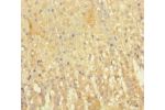 Immunohistochemistry of paraffin-embedded human adrenal gland tissue using CSB-PA007643LA01HU at dilution 1:100