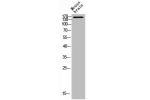 Western Blot analysis of MOUSE-BRAIN cells using DAPK1 Polyclonal Antibody