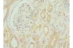 Immunohistochemistry of paraffin-embedded human kidney tissue using CSB-PA007648LA01HU at dilution of 1:100